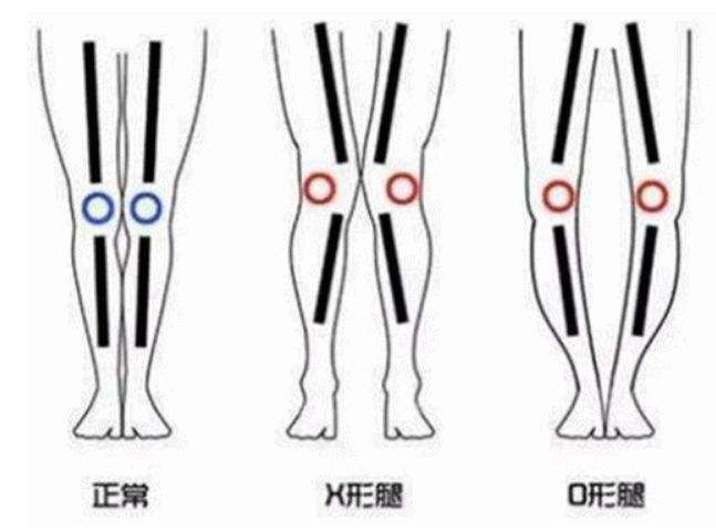 博鱼电竞在家就能练的冰球专项体能训练——X型腿纠正训练（一）(图1)